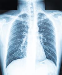 chest x-ray