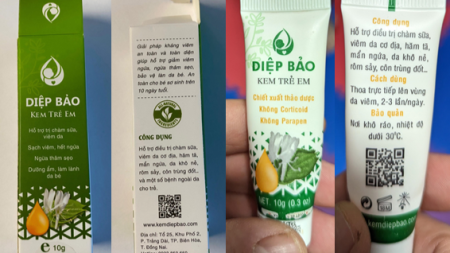 Lead Contamination for Diep Bao Cream
